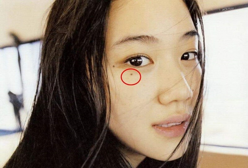 Nốt ruồi lệ ở mắt trái nữ