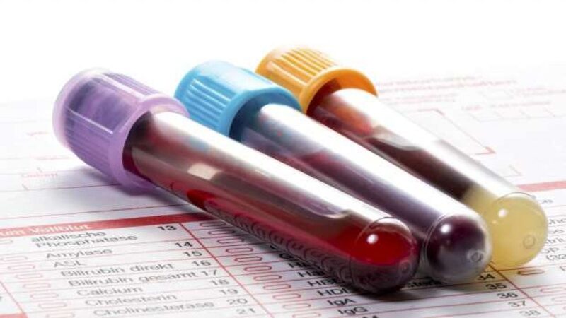 Xét nghiệm công thức máu: ý nghĩa và các chỉ số quan trọng